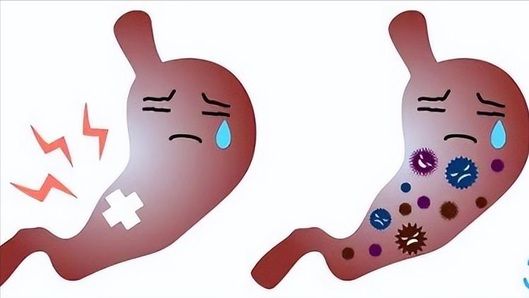 幽门螺旋杆菌阳性dpm值1145严重吗,幽门螺旋杆菌阳性值为00340严重吗