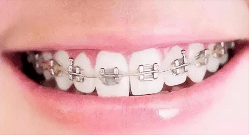 牙周病牙齿松动怎么治疗用什么药,牙周药物治疗的目的