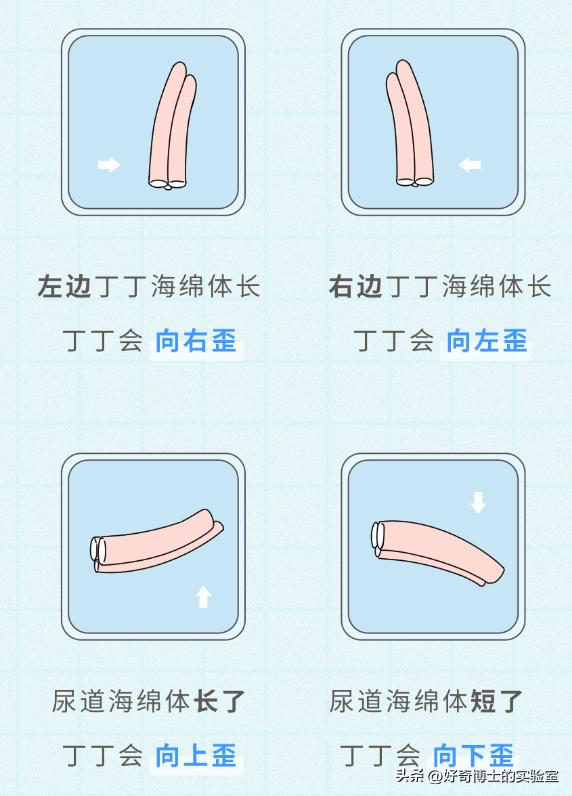 男生丁丁变歪是身体出了什么问题吗？影不影响*生活性**？