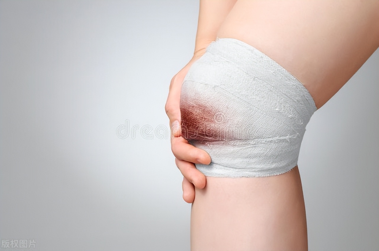 伤口贴纱布怎么能不粘连,伤口密封好还是通风好