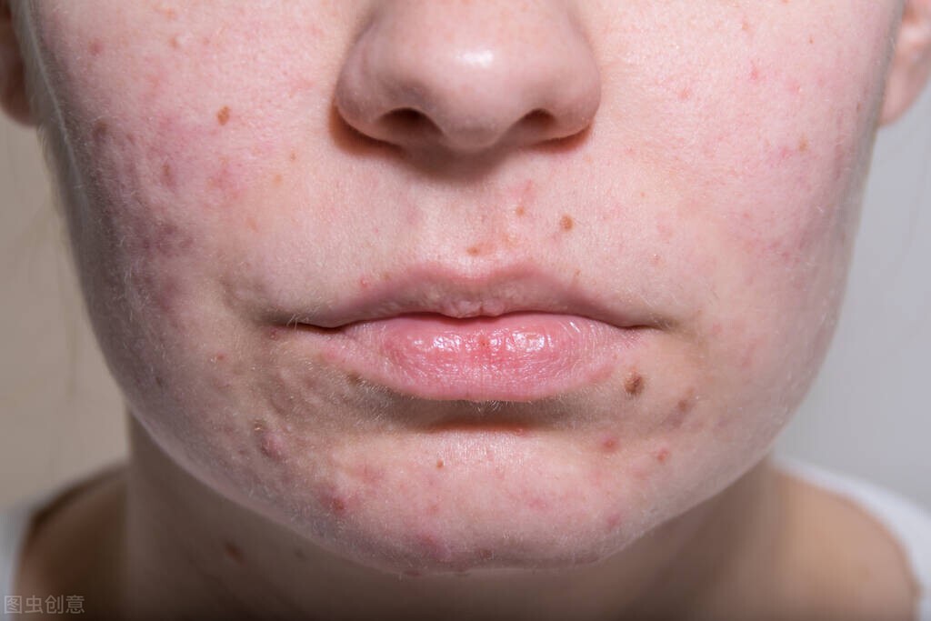 连续三天不洗脸皮肤会变好吗,三天不洗脸会怎么样