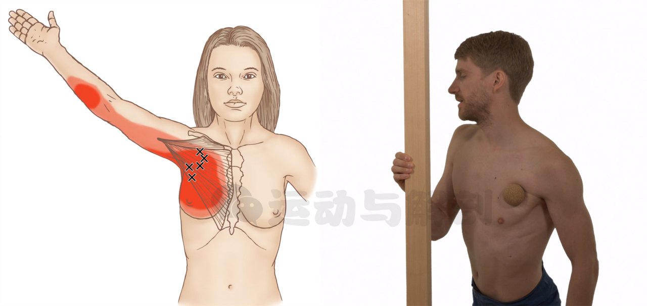 胸大肌太紧了怎么办？切记不要直接拉伸！