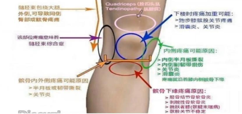 宣武医院疼痛科主任杨立强,宣武医院疼痛科杨立强讲座