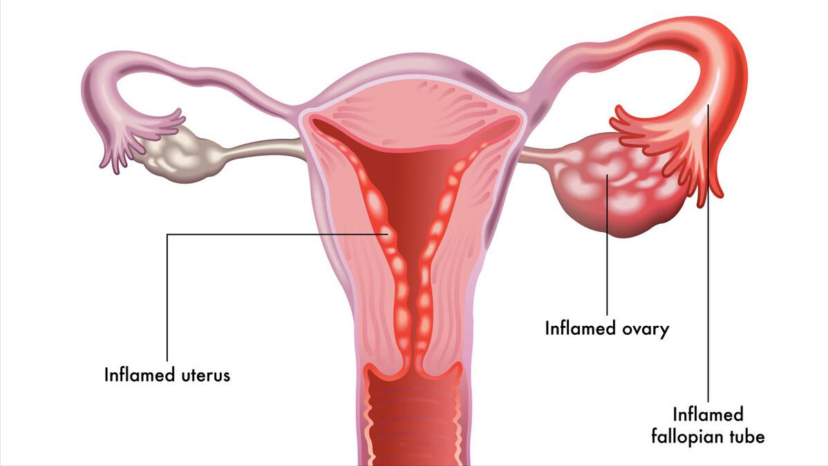 为啥医生总问你有没有男朋友？去妇科检查前这些知识你要知道