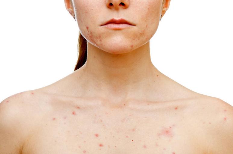 人体润滑剂，对女性伤害大还是对男性？能长期用吗？看完涨知识了