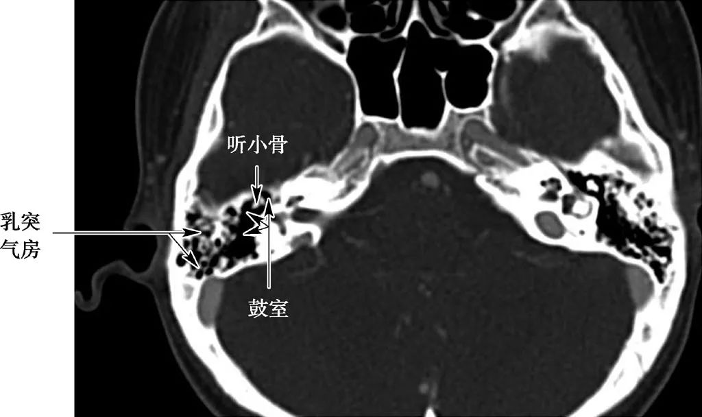 耳部解剖结构和生理功能,耳部解剖笔记