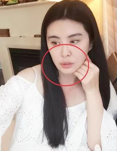 明明是绝顶大美女，却被牙齿拉胯，这15位女星苦不堪言