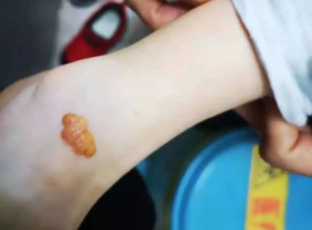 小学学校体检一般检查哪些项目,检测标准的一般变更和重大变更