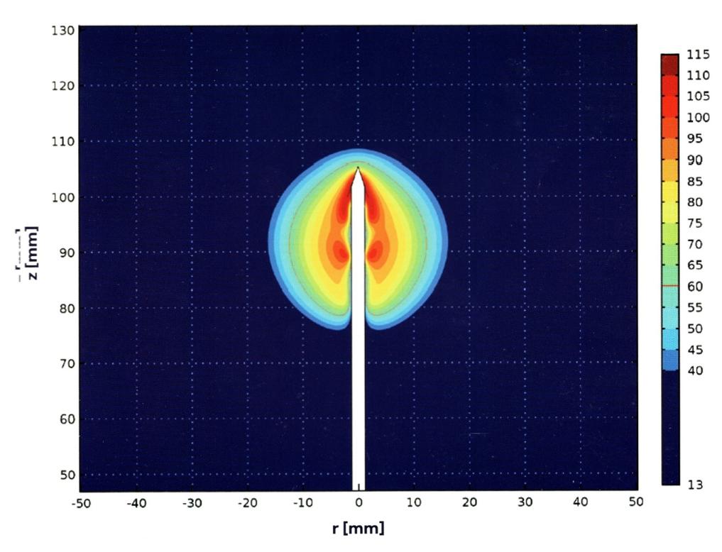左肺上叶8*5mm磨玻璃结节最坏结果,发现肺磨玻璃小结节怎么办