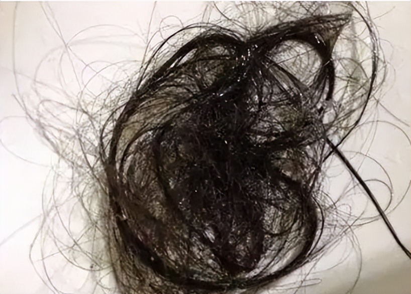 生发液推荐平价学生国货,适合头发少的生发液真实测评