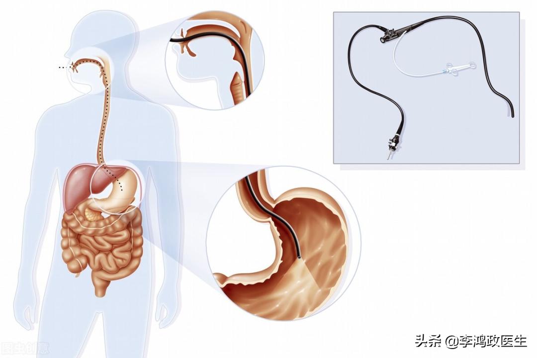 什么体检项目是筛查癌症最好方法,女性癌症筛查体检项目几年一次
