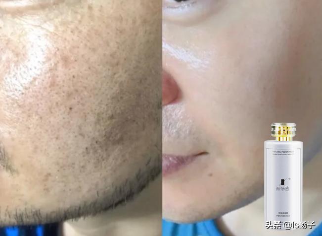 肤色变白最有效的方法,如何让又黄又暗肤色变白