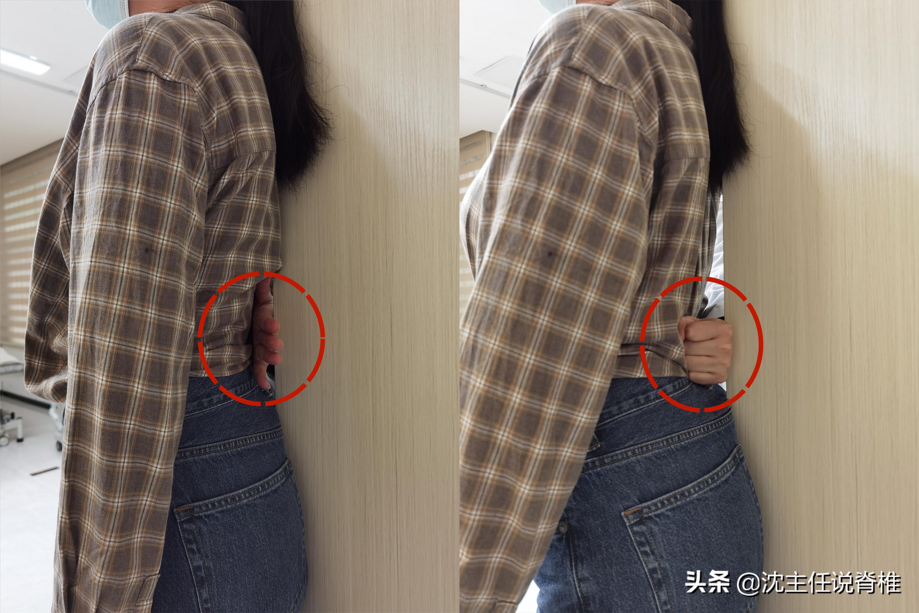 腰骶痛是不是腰突,腰骶疼是腰间盘突出吗