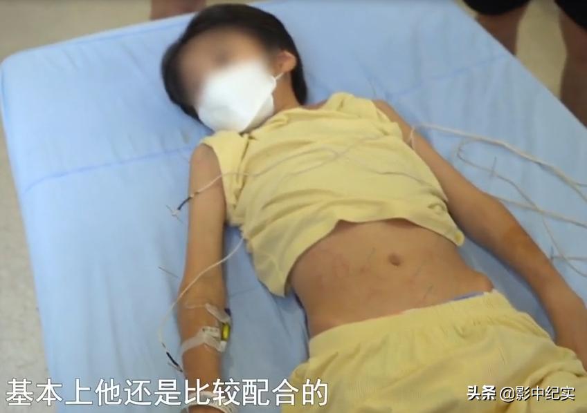 十岁的男孩开卡丁车追尾,10岁男孩玩卡丁车拦腰截瘫