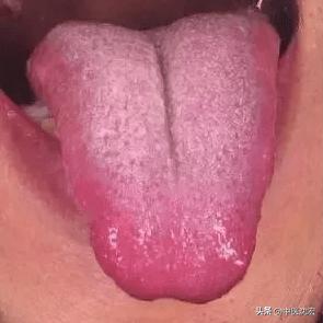 肝不好，人易倒，肝不好有这5种表现，教你5种中成药，养肝调肝