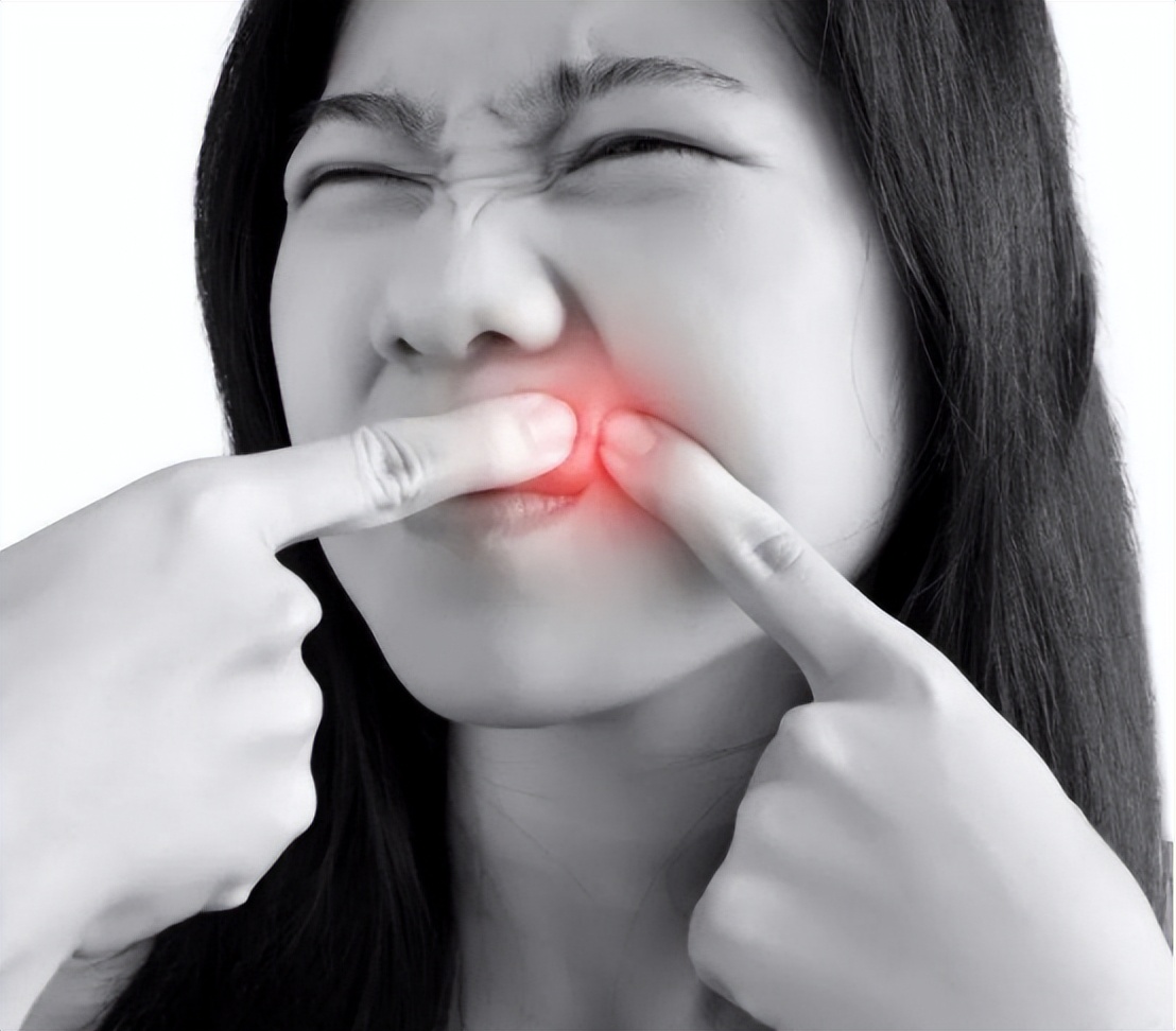 嘴上出了好多透明水泡会传染吗,嘴上上火长水泡会传染吗