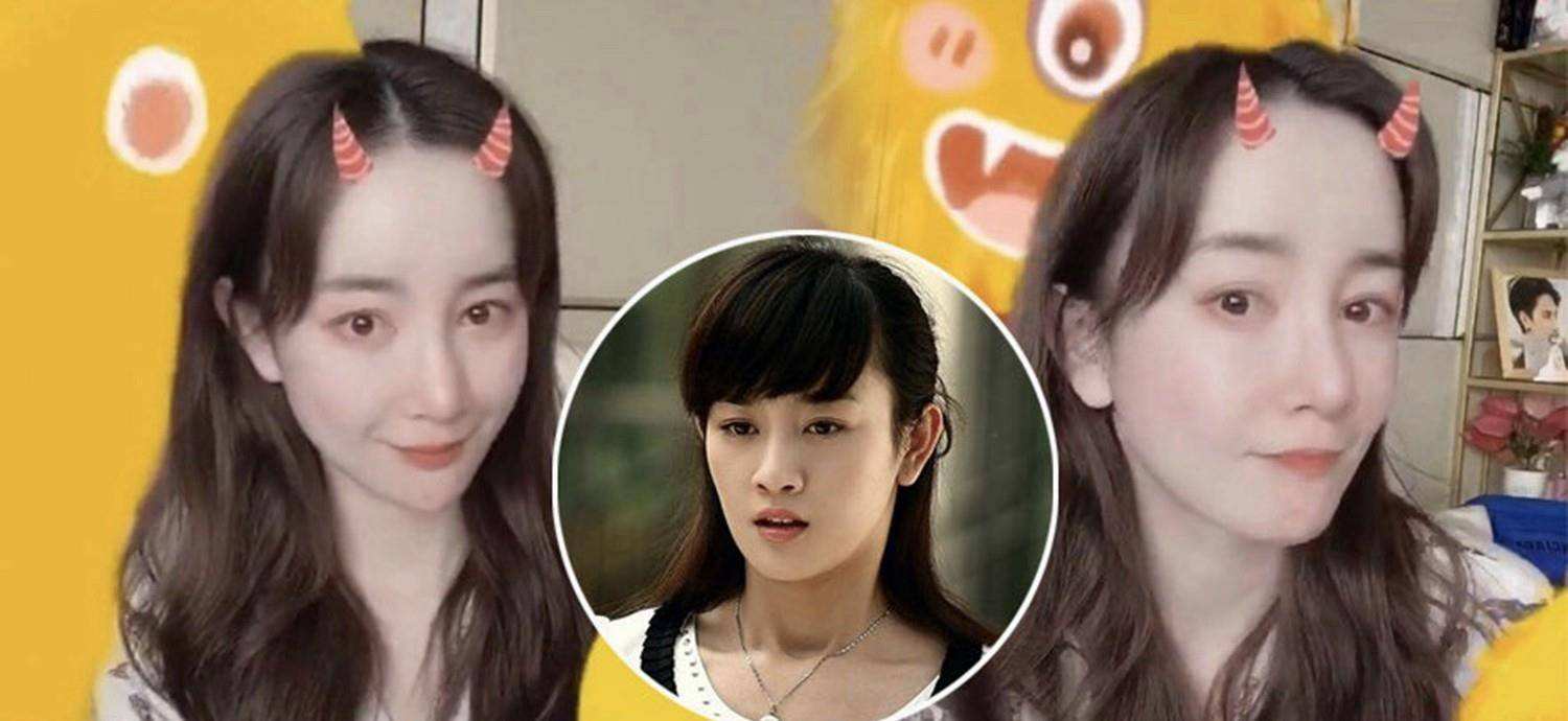 最失败硅胶脸的女星,硅胶脸女明星排行