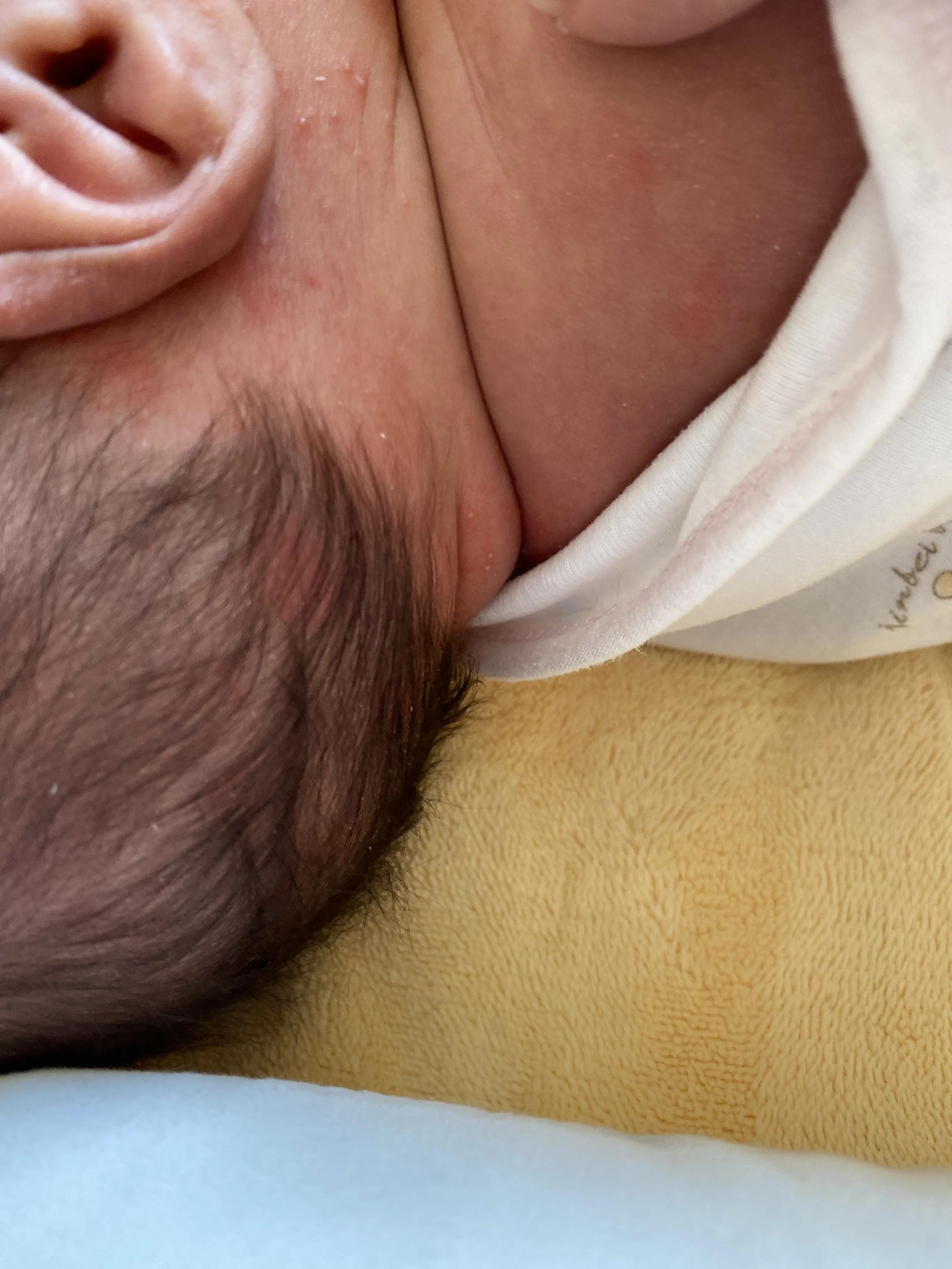 满月婴儿湿疹挂什么科,满月婴儿长湿疹抹什么药膏