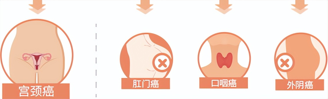 最小患者9个月,最小的患者