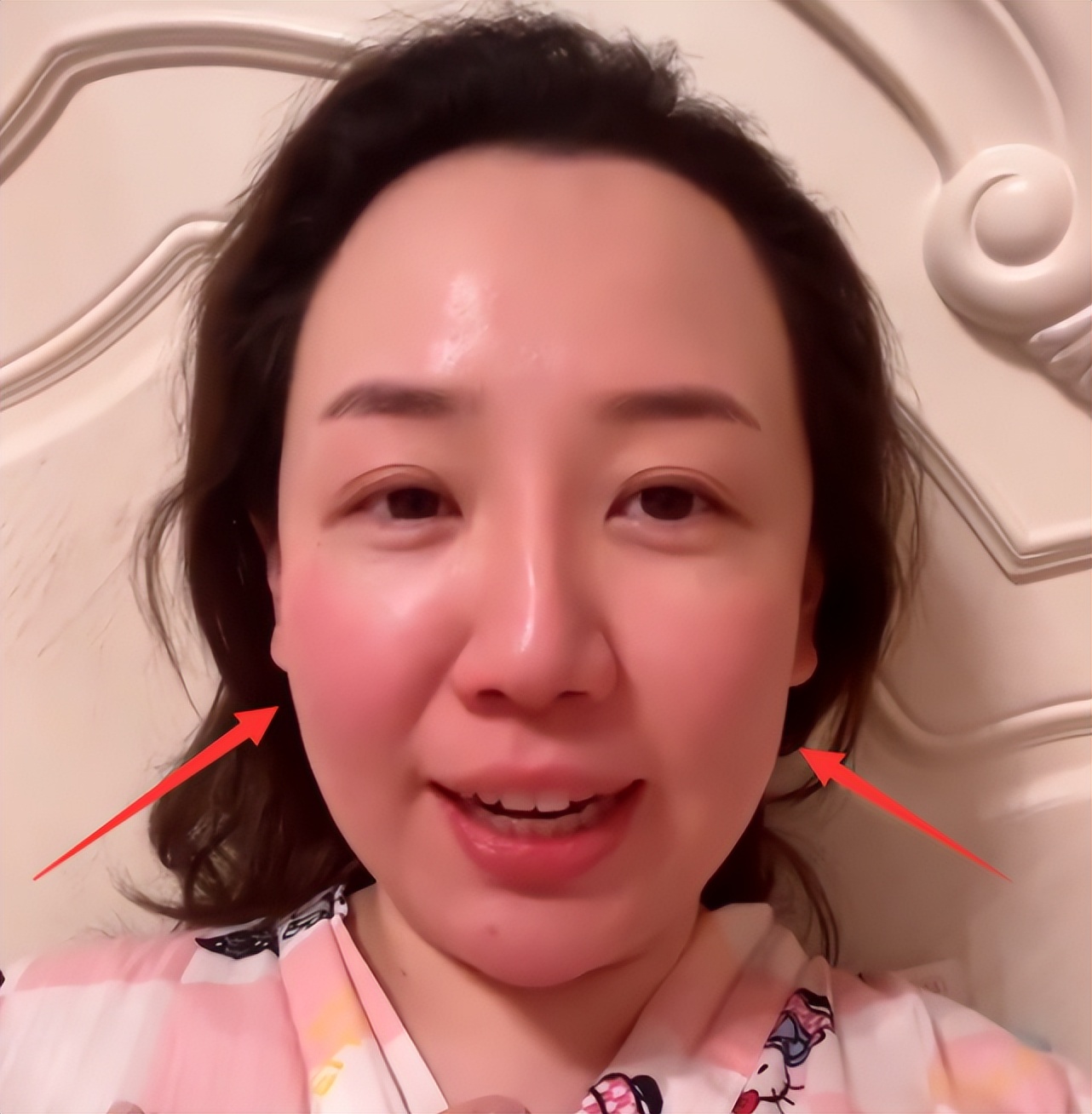 童星关凌感染新冠，自曝持续高烧嗓子哑到失声，还没有食欲脸通红