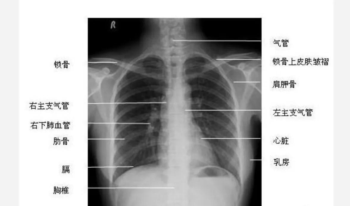 咳嗽吃药一直不好反复咳嗽,为啥咳嗽吃了药不管用