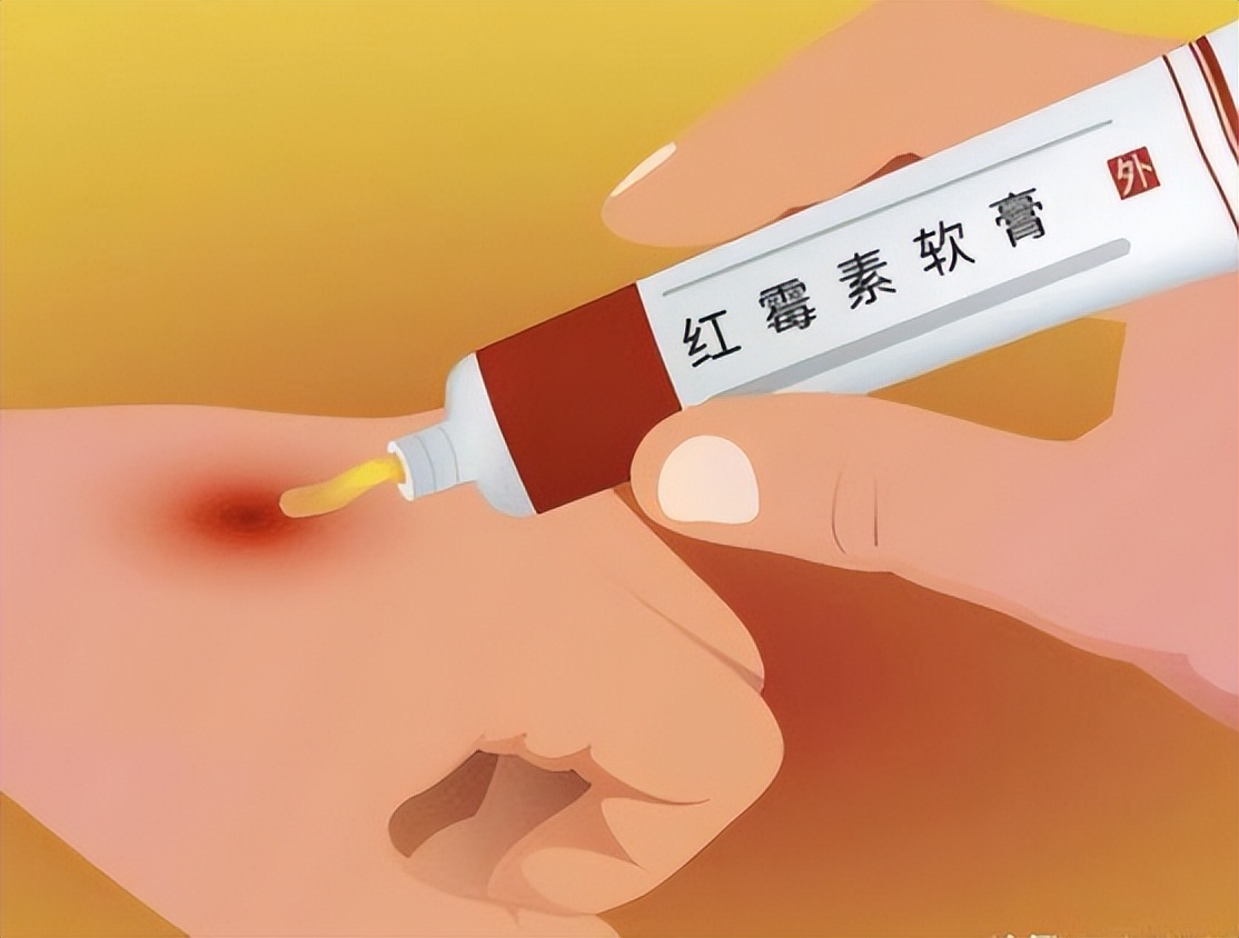 红霉素和金霉素软膏的作用和功效,红霉素软膏和红霉素眼膏作用功效