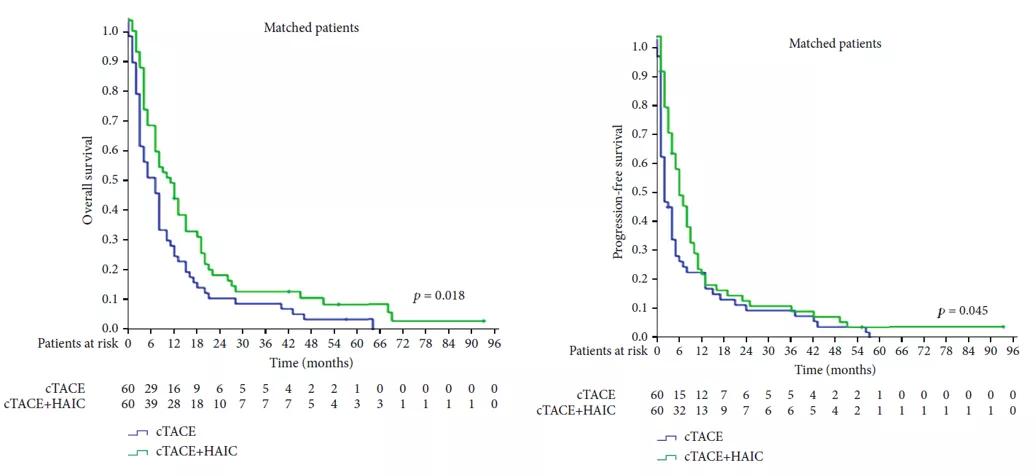 朱旭教授：肝脏介入治疗成为肝脏恶性肿瘤的一种重要治疗手段