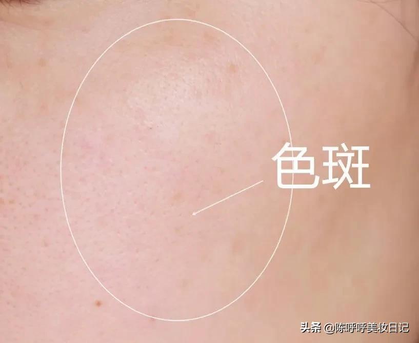 科颜氏美白淡斑精华测评含铅汞吗,科颜氏美白淡斑精华液有效