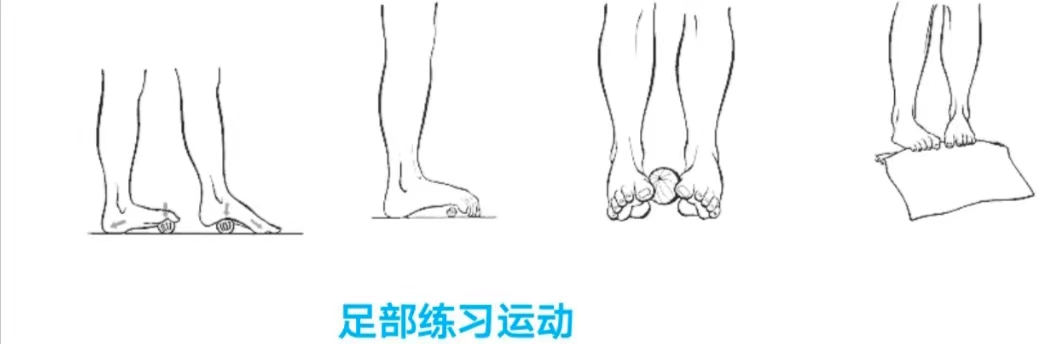 儿童拇外翻如何干预,儿童拇外翻可以治疗吗