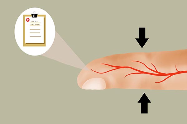 警惕脚部发出的衰老信号,女人脚部衰老的征兆四大表现