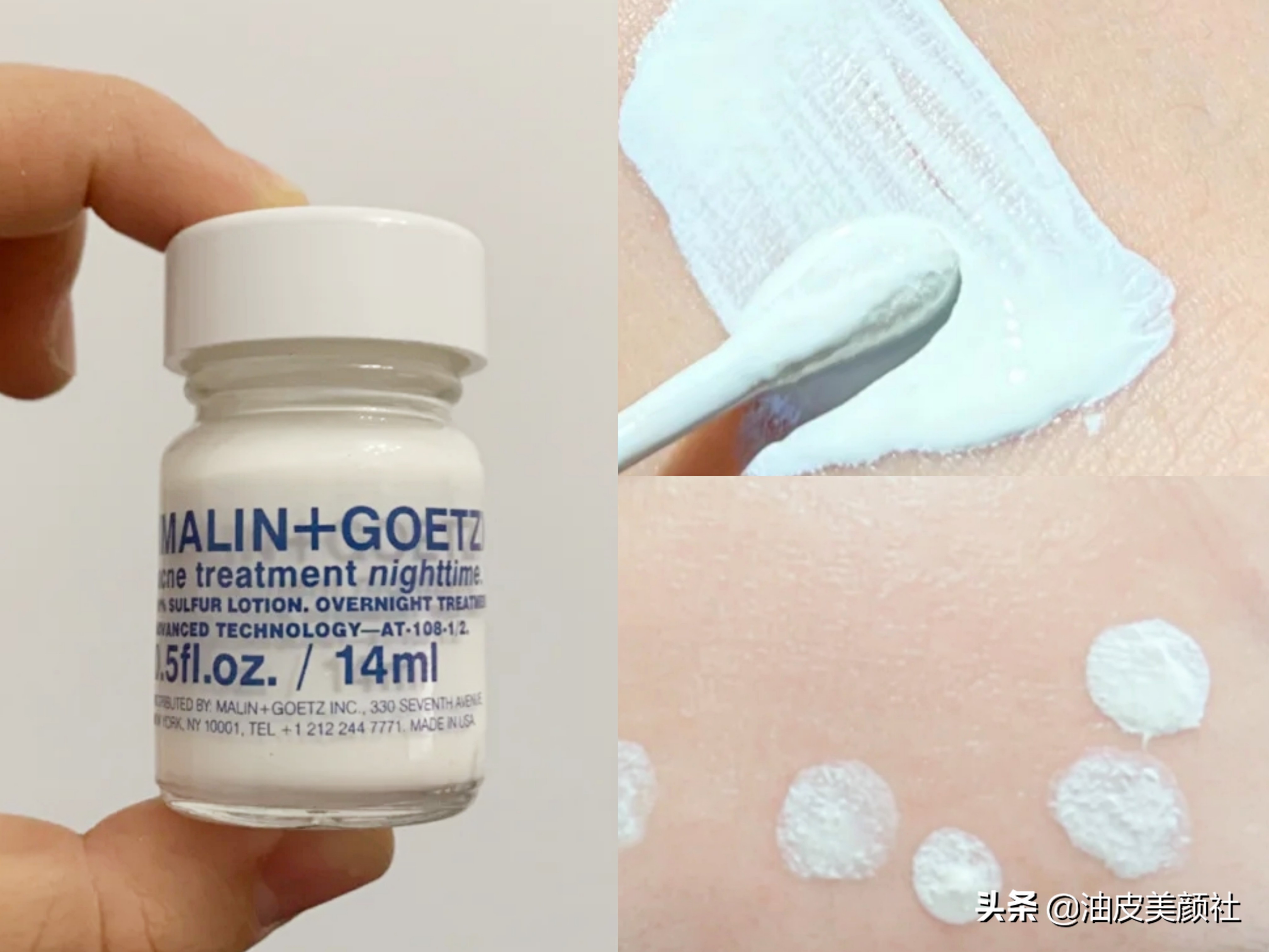 祛痘好物推荐一下,推荐十款实用的祛痘产品