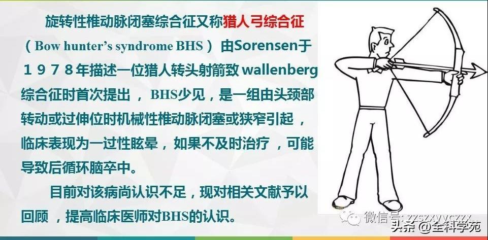 条件反射性眩晕,一种莫名的眩晕