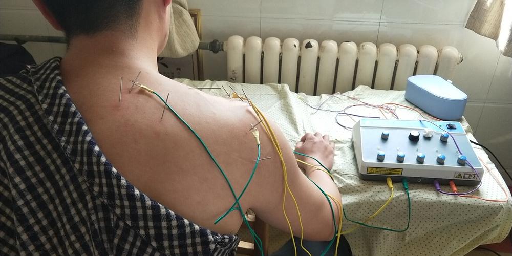 中医脚底筋膜炎如何彻底治愈,筋膜炎肩部最快的治疗方法中医