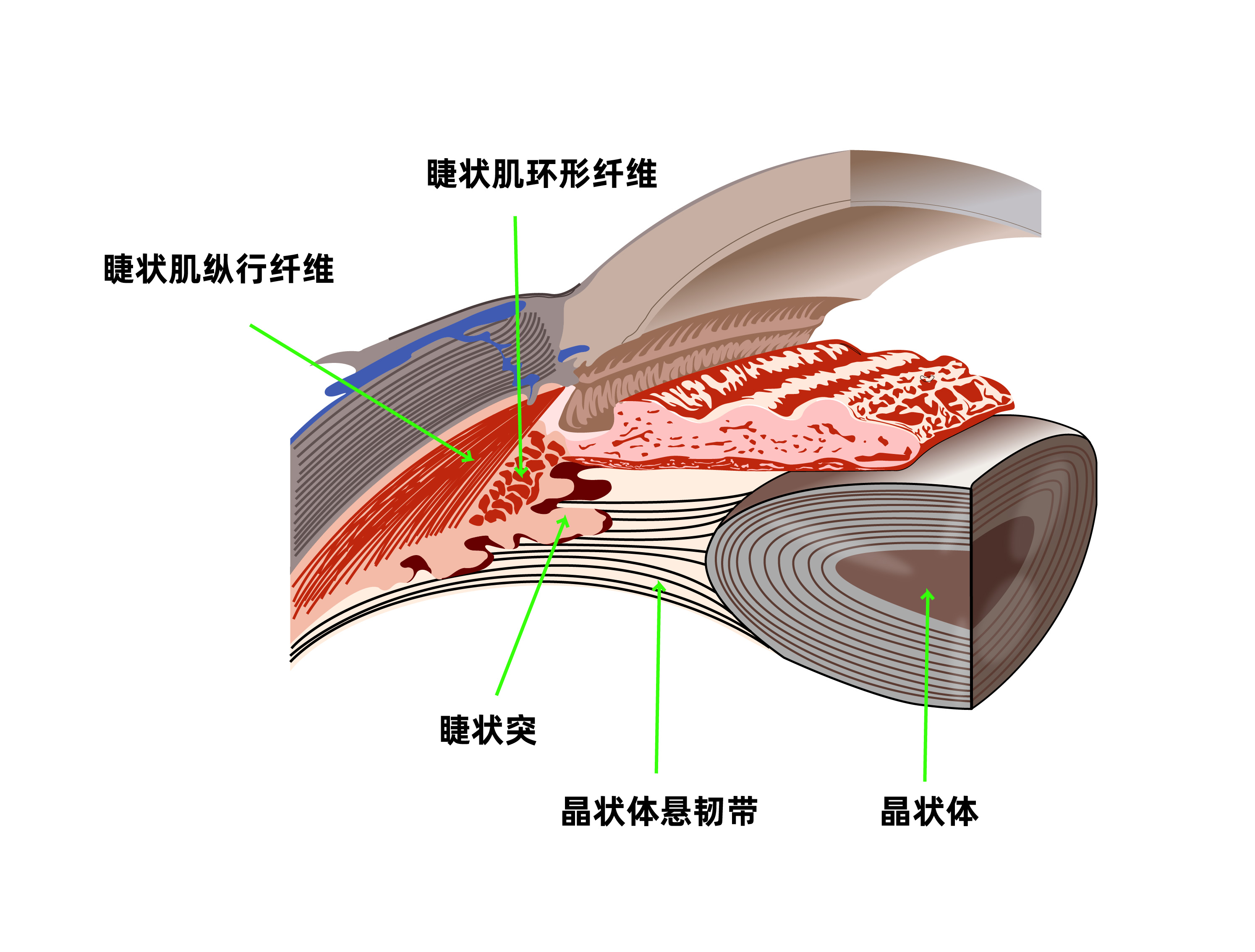 视力1.75还能恢复吗,视力1.75近视算严重吗