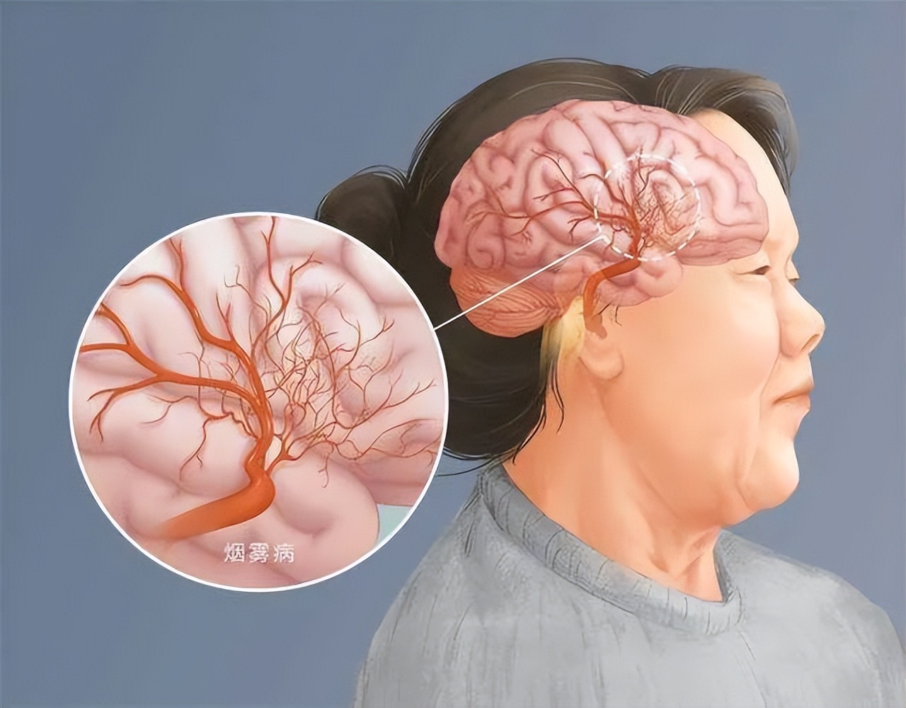 头昏眼花全身无力是不是中暑,头晕眼花是没休息好吗