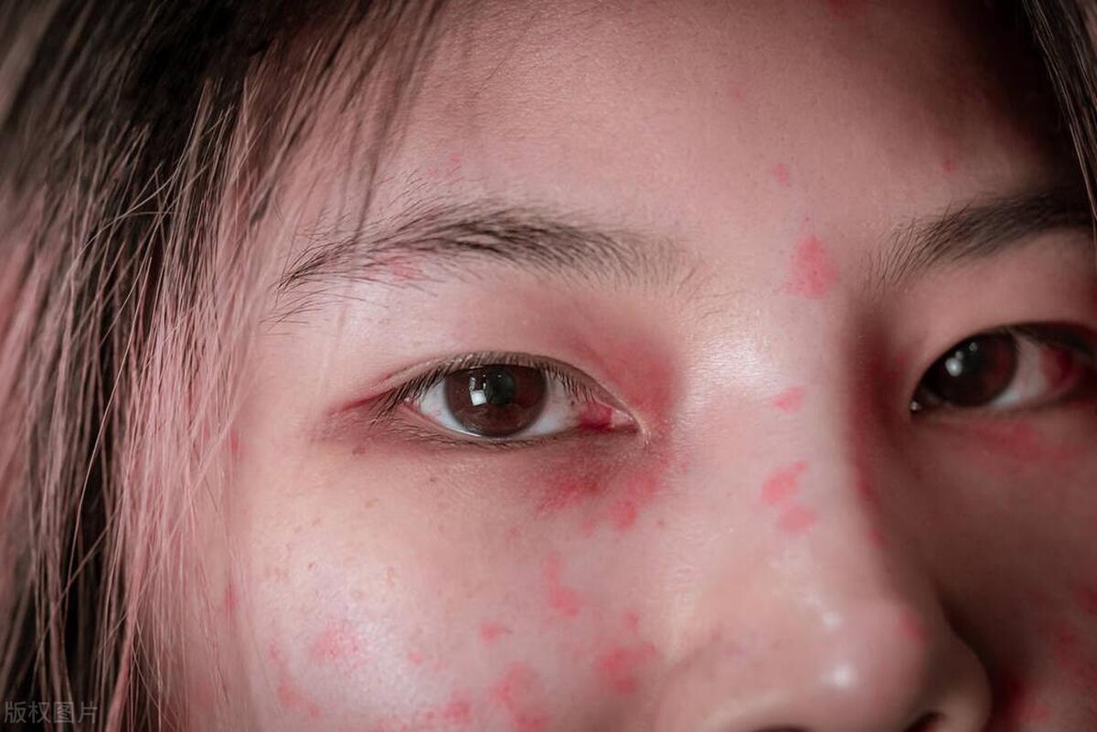 涂抹式的水光针效果怎么样,涂抹式水光针好坏