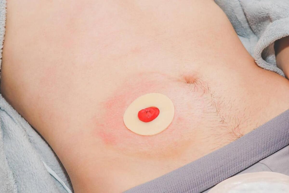 医生提醒你，这3个部位别乱亲，不然身体告诉你后果