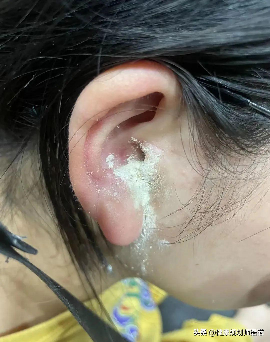 因宫颈问题走进阳光森林，用营养拯救了整个家族的健康