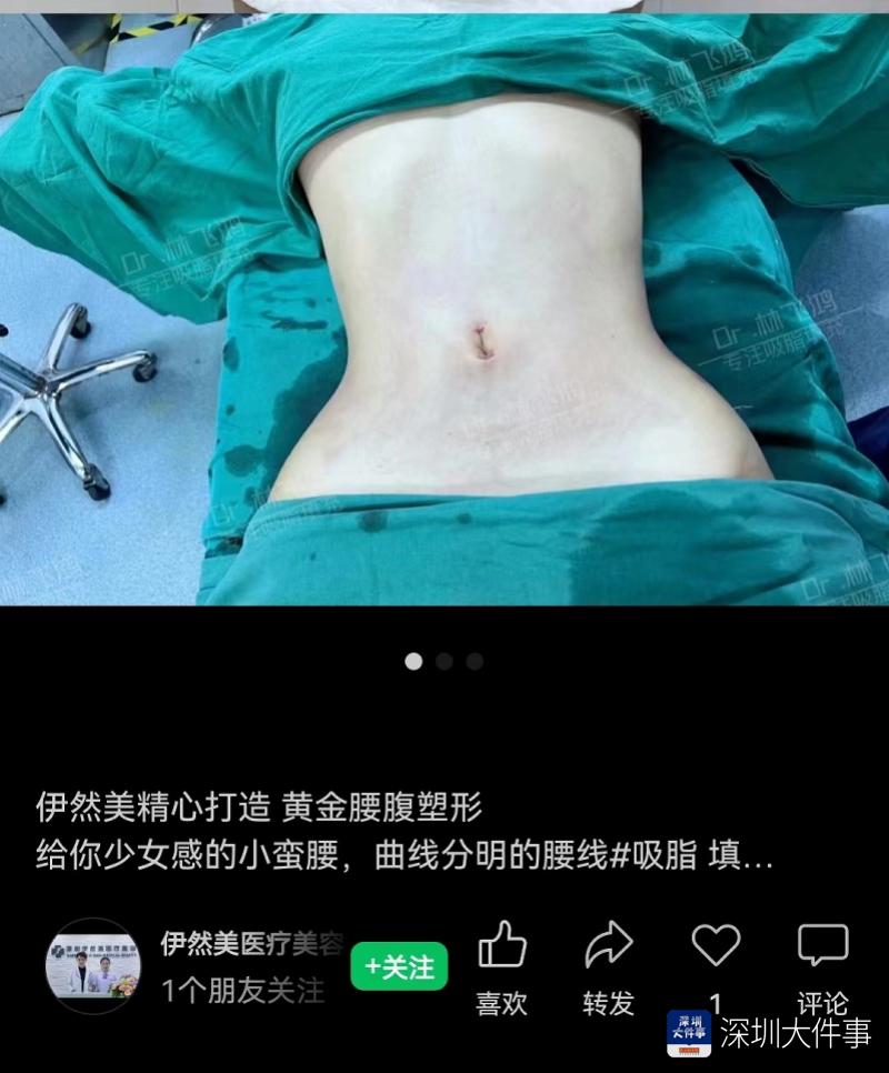 南都调查：医美“野麻”泛滥？无麻药购用资质却做全麻手术