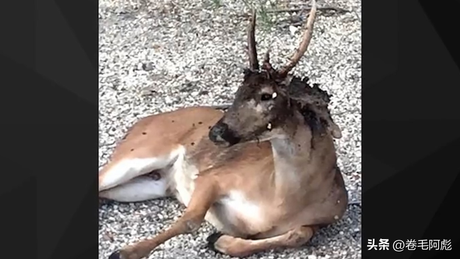女子被12只蜱虫咬,美国女子被虫子咬