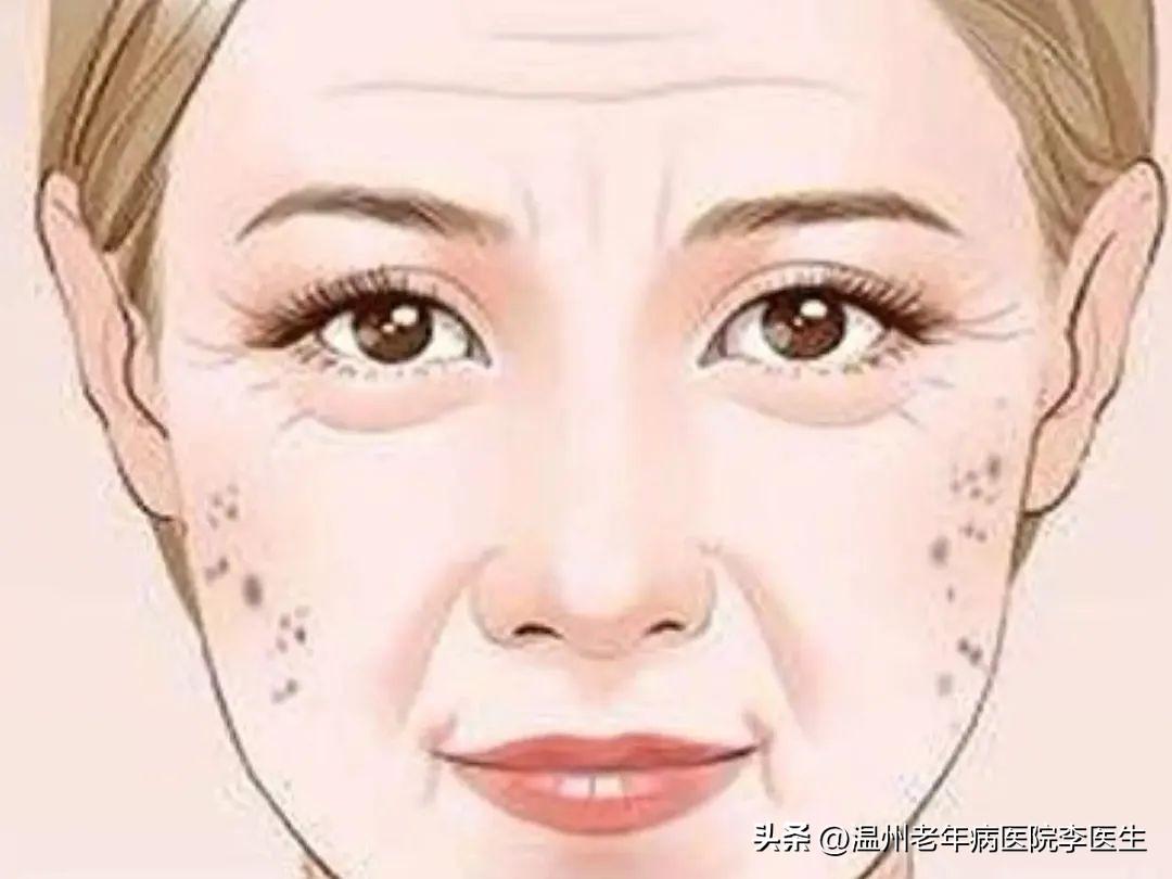 光子嫩肤真的嫩肤吗,美白嫩肤光子