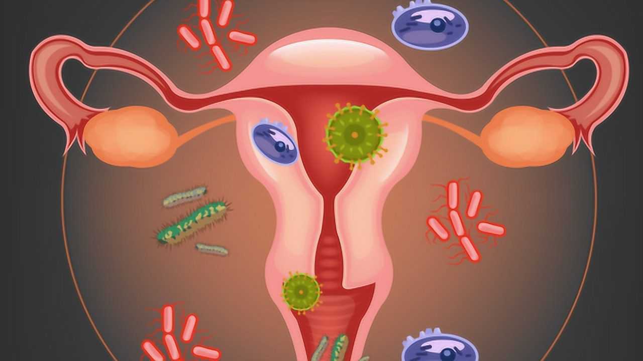 月经走后就有妇科病为啥,月经走后又来了需要吃药制止吗