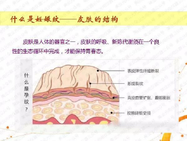 孕期涂橄榄油真的能预防妊娠纹吗,孕期涂食用橄榄油可防止妊娠纹不