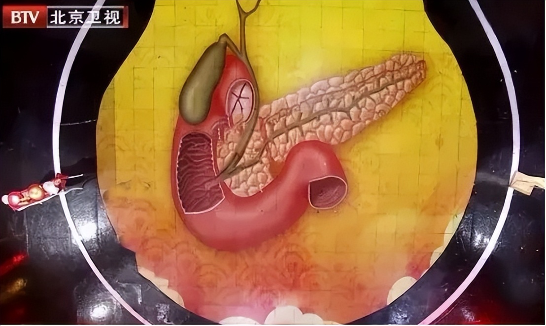最近身体各个地方相继发炎,吃的东西会导致身体急性炎症