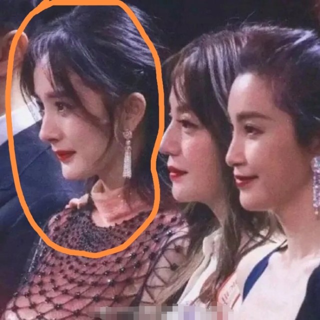 杨幂“拔牙后遗症”犯了！打脸说整容的人，粉丝：这毛病可以接受