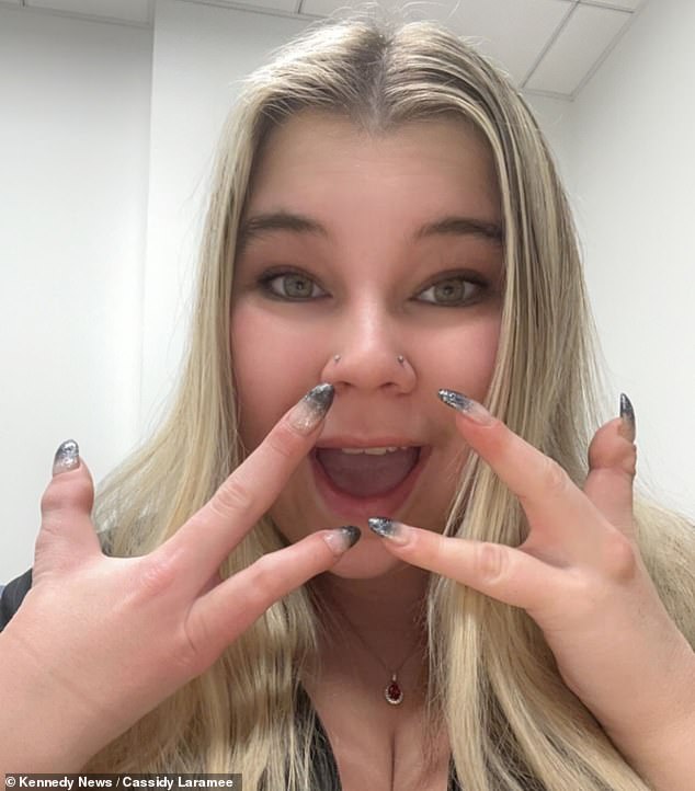 妹子天生只有3根手指，别人说她“霸王龙”，她用乐观狠狠反击！