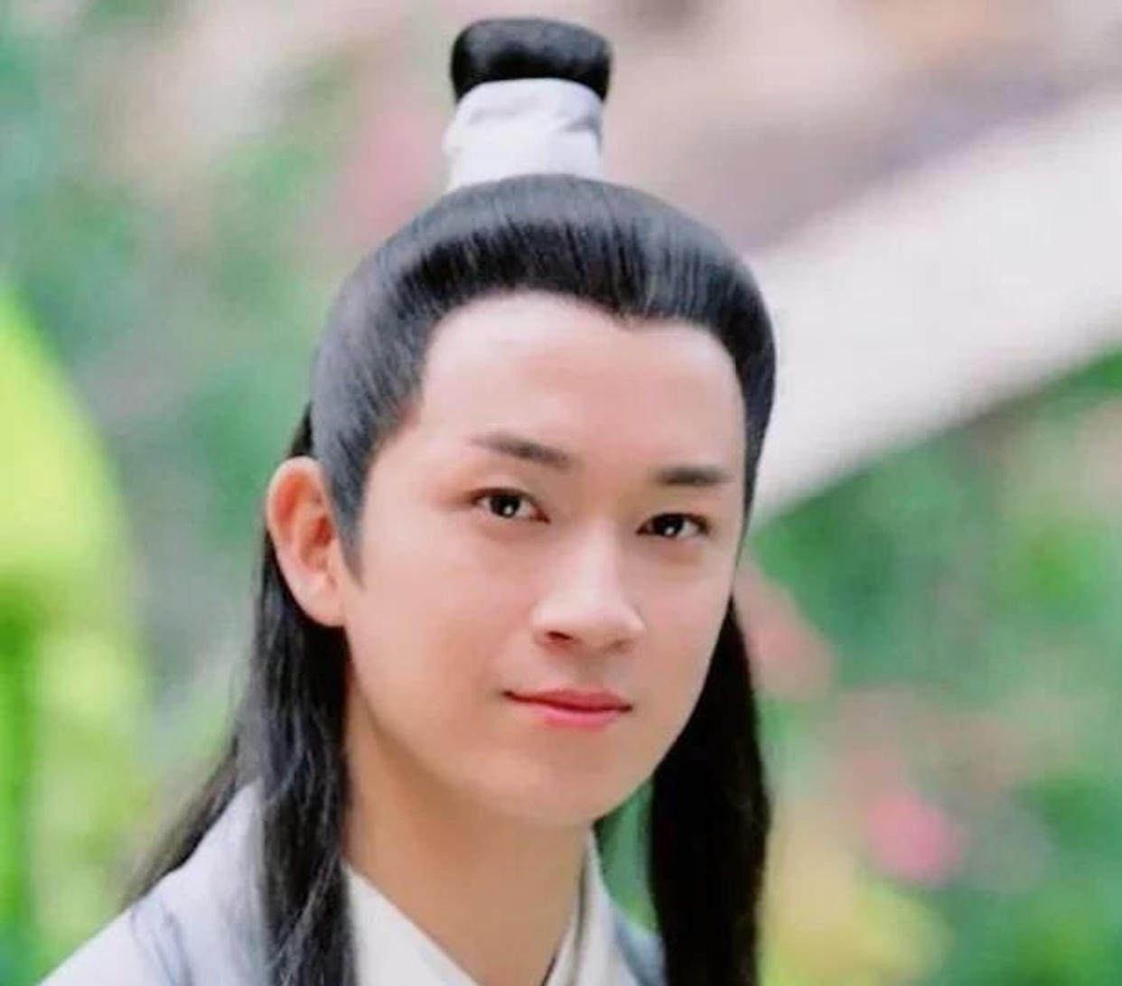 明星脸部僵硬的图片,很多明星脸僵是怎么回事