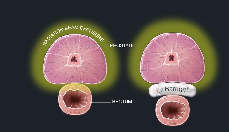 46亿元,知名械企宣布重大收购