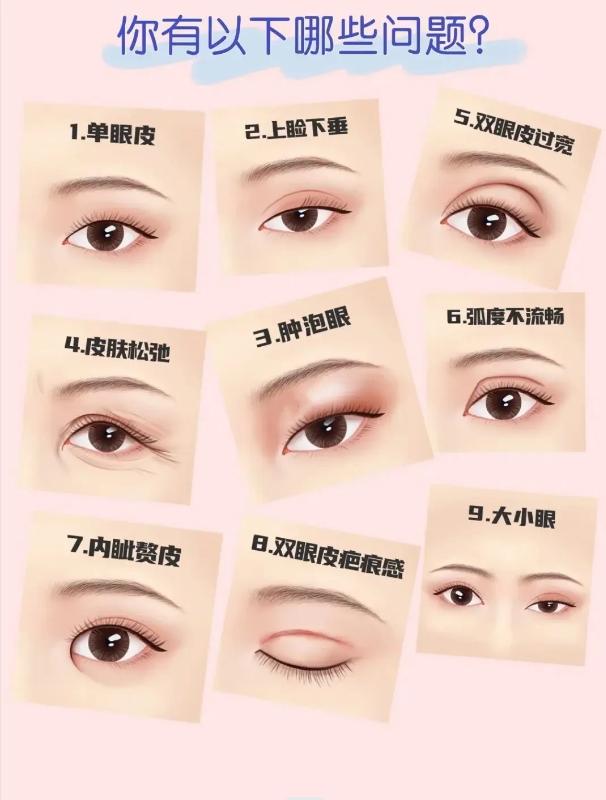 西南医院做双眼皮哪个医生做得好,做双眼皮怎样选专业