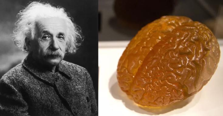 鐖卞洜鏂潶鍘讳笘瑙ｅ墫澶ц剳,鐖卞洜鏂潶澶ц剳涓㈠け涔嬭皽